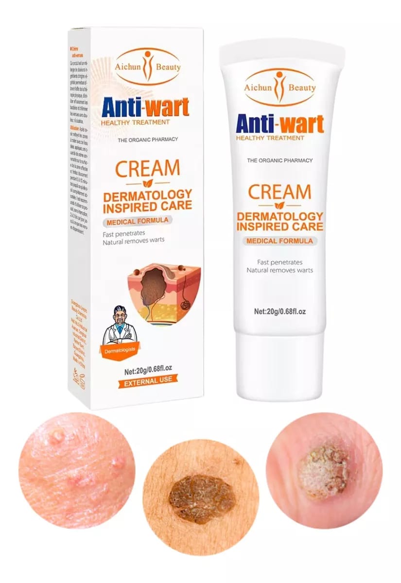 Crema dematologa para eliminar verrugas
