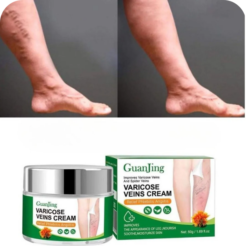 🌿Crema Venox: Alivio y Cuidado para tus Várices🌿🪴🪷