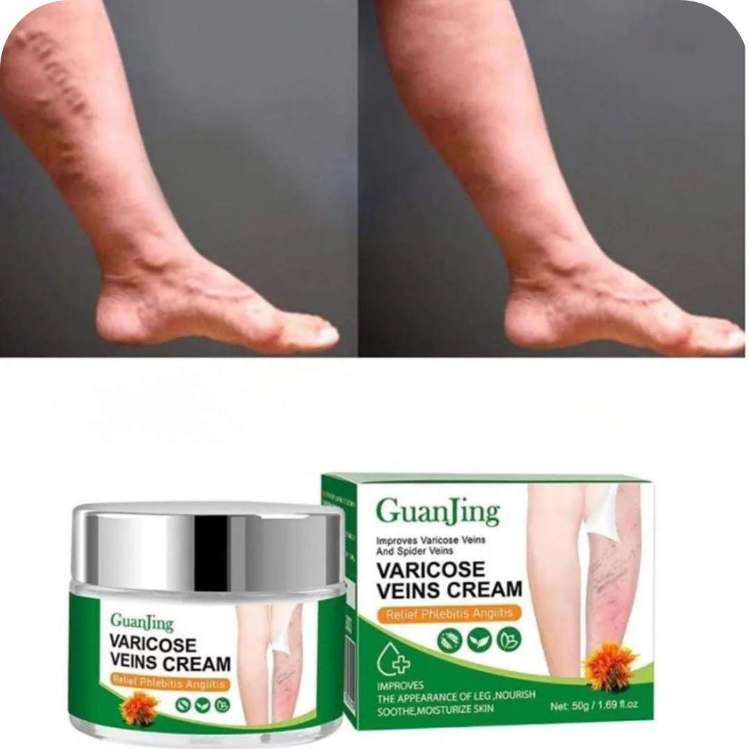 🌿Crema Venox: Alivio y Cuidado para tus Várices🌿🪴🪷
