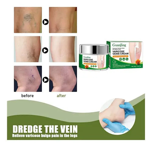 🌿Crema Venox: Alivio y Cuidado para tus Várices🌿🪴🪷