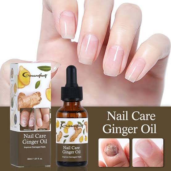 "¡Dile Adiós a los Hongos de Uñas en Tiempo Récord!"🍀🔥